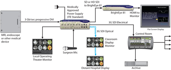 Scan conversion for medical facilities with Ensemble Designs BrightEye Mitto Scan Converter from Ensemble Designs